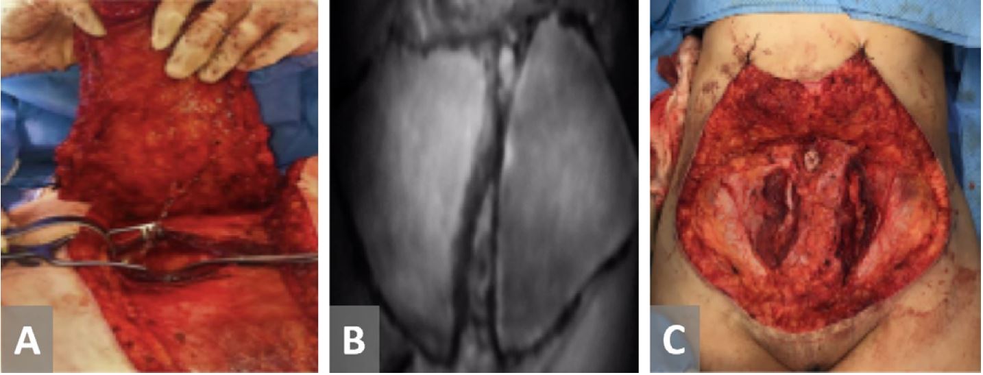 Figure 5.JPG